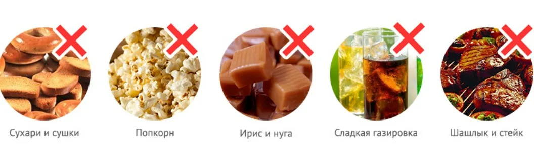 Металлические или керамические: какие вестибулярные брекеты выбрать